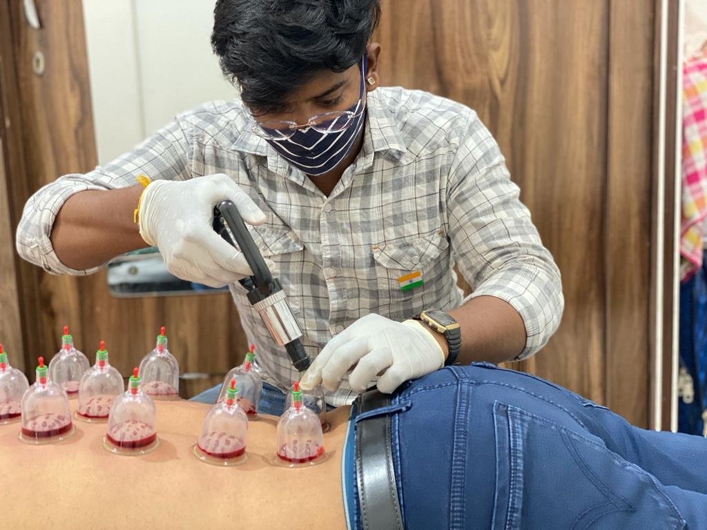 Diploma in Cupping Therapy | Dr. Hitesh Kamble