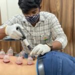 Diploma in Cupping Therapy | Dr. Hitesh Kamble