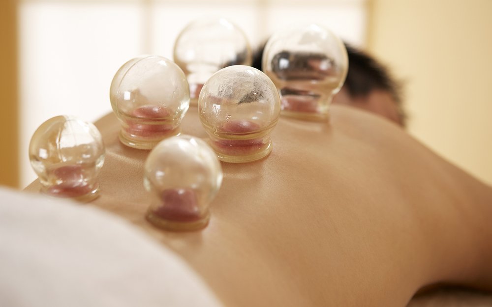 Cupping Therapy | Adiyogi Cupclinic