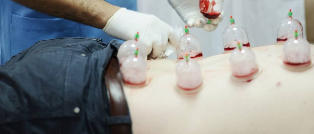 Cupping Therapy Clinic Ambernath, Mumbai