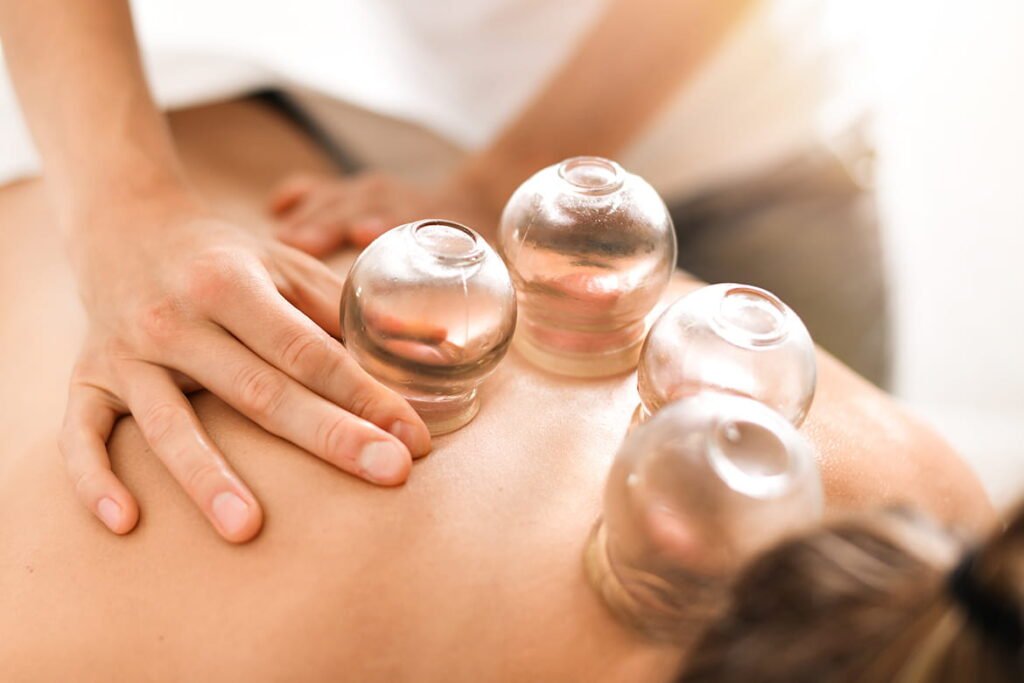 Best Cupping Therapy Classes