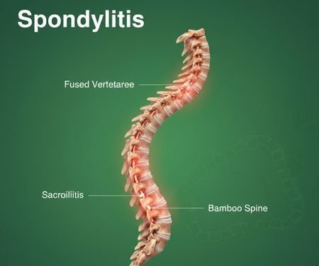 Chiropractic Treatment Clinic in Badlapur, Mumbai